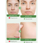 CalmClean Gentle Cleanser