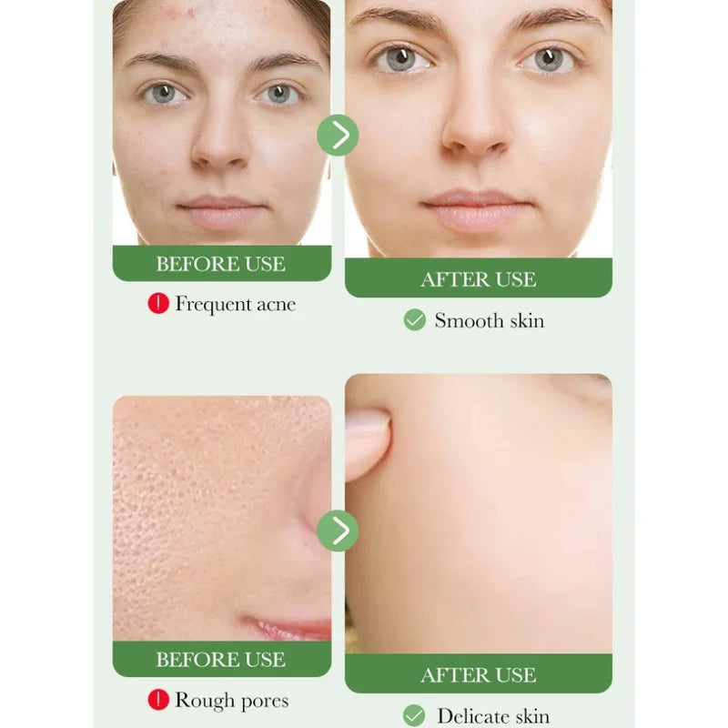 CalmClean Gentle Cleanser